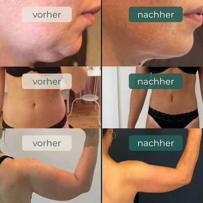 Lymph-Drainage (Frauen)